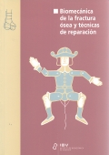 Biomecnica de la fractura sea y tcnicas de reparacin.